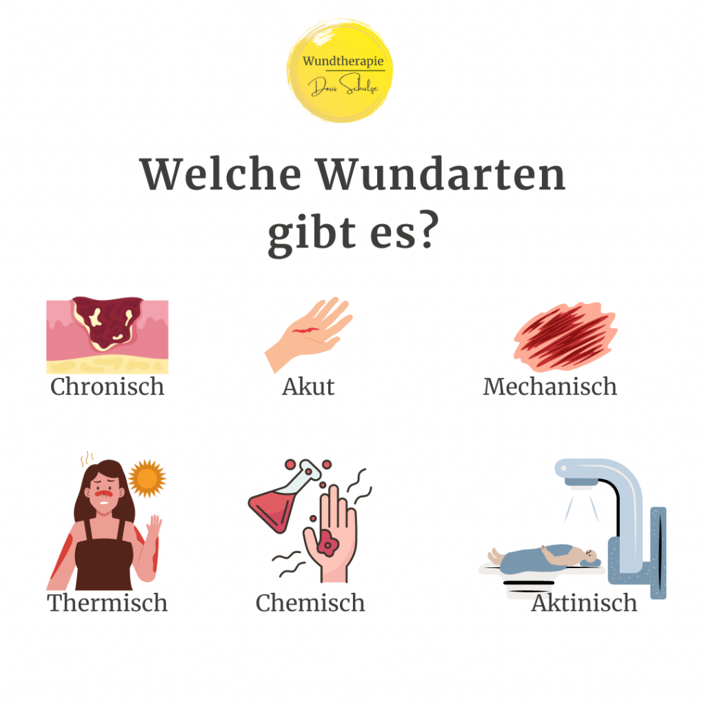 Die Welt der Wundarten